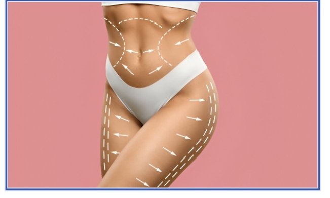 Body