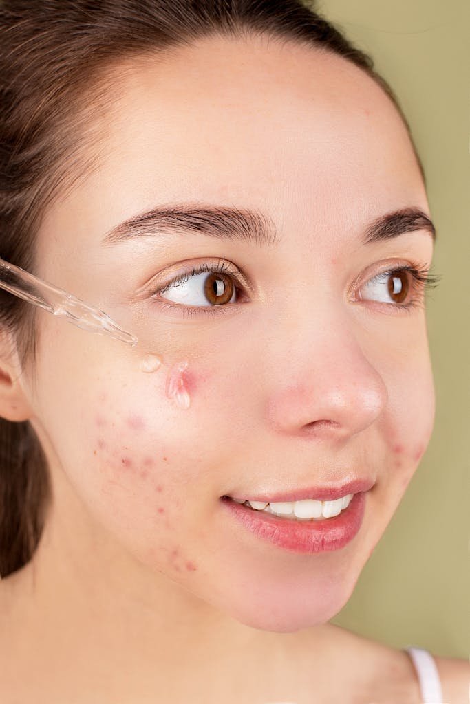 Skin Care in Hindi Wellhealthorganic Skin Care in Hindi Wellhealthorganic Close-up of a young woman applying serum on her face for acne treatment and skincare routine.