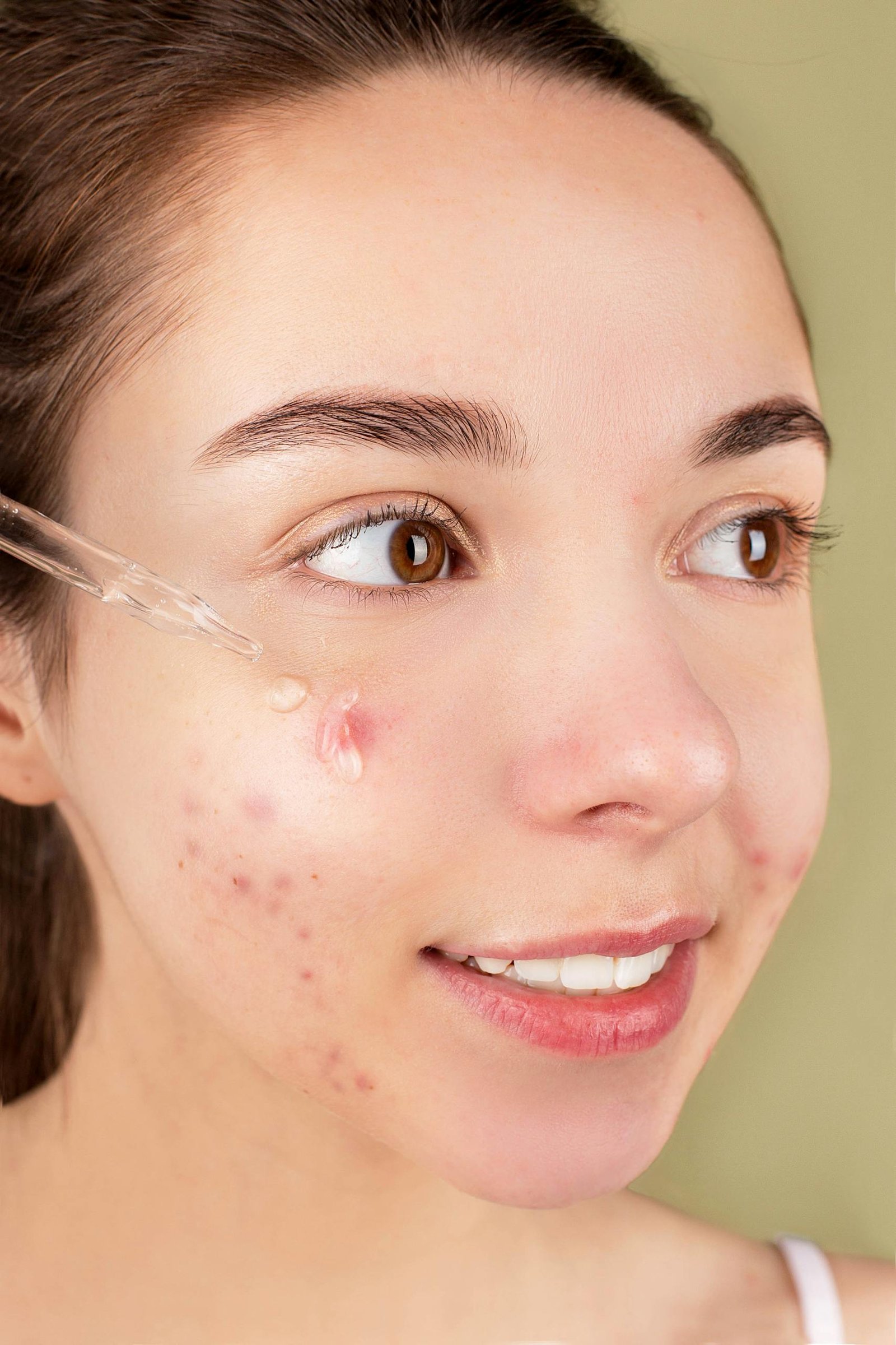 Skin Care in Hindi Wellhealthorganic Skin Care in Hindi Wellhealthorganic Close-up of a young woman applying serum on her face for acne treatment and skincare routine.